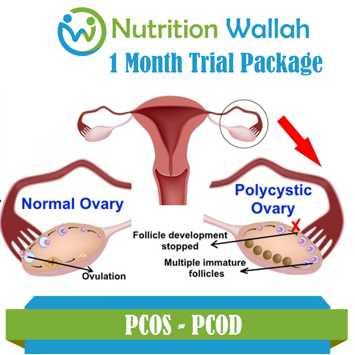 Trial Package PCOS- PCOD Woman Care
