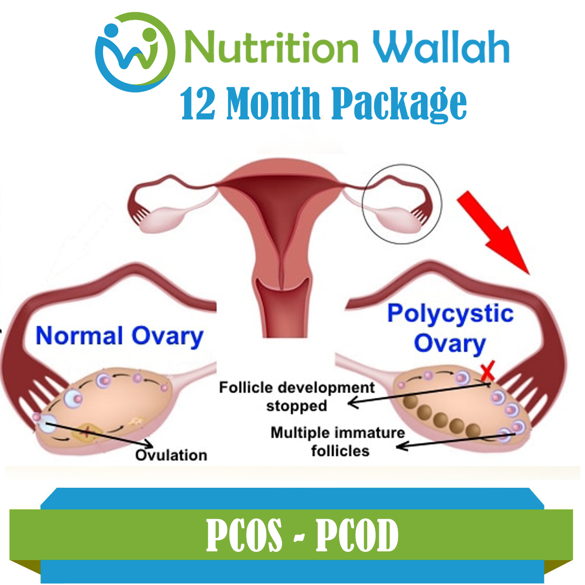 12 Month Package PCOS- PCOD Woman Care